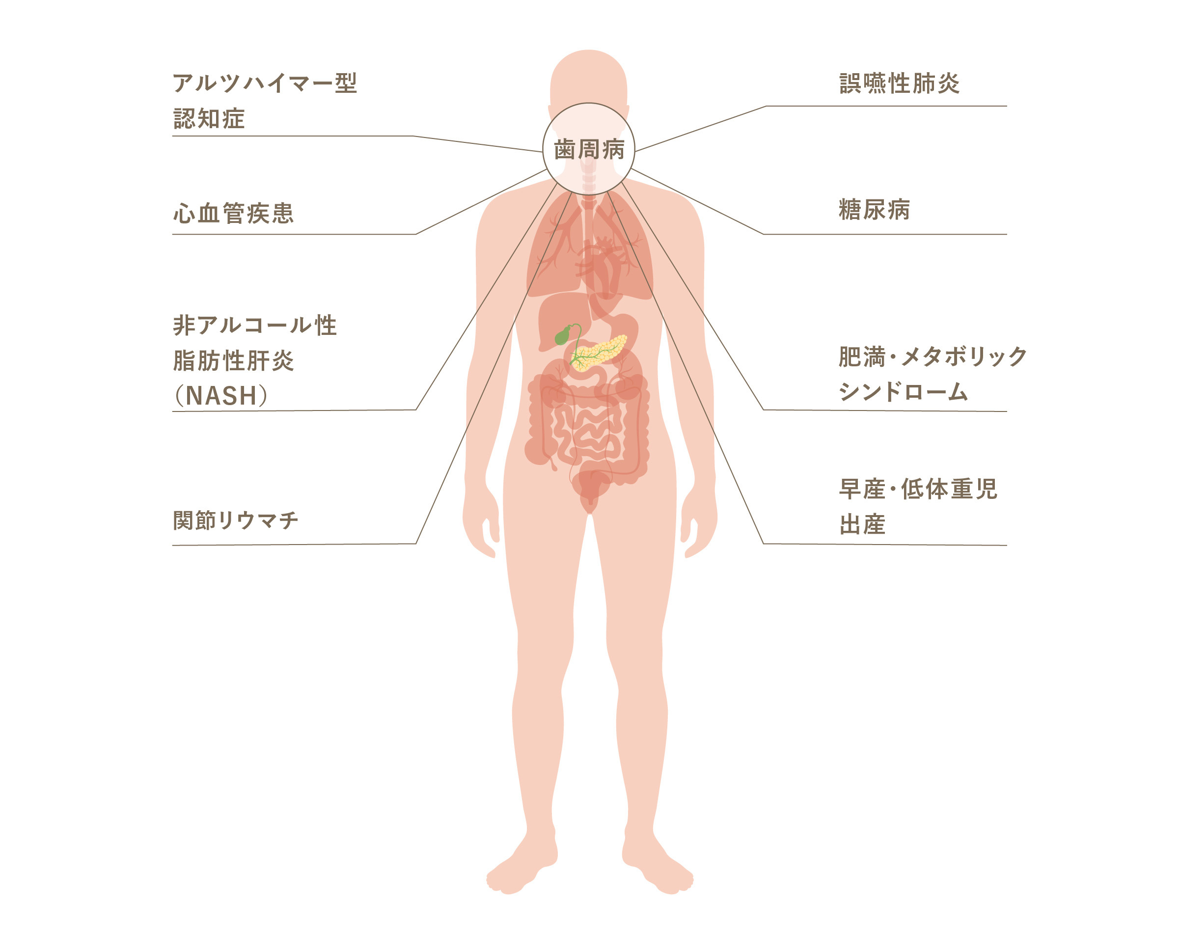 ⻭周病と全⾝疾患の関連